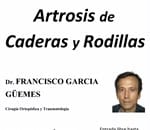 Artrosis de Caderas y Rodillas